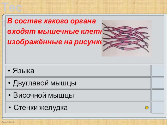 22.03.2016 В состав какого органа входят мышечные клетки, изображённые на