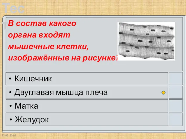 22.03.2016 В состав какого органа входят мышечные клетки, изображённые на