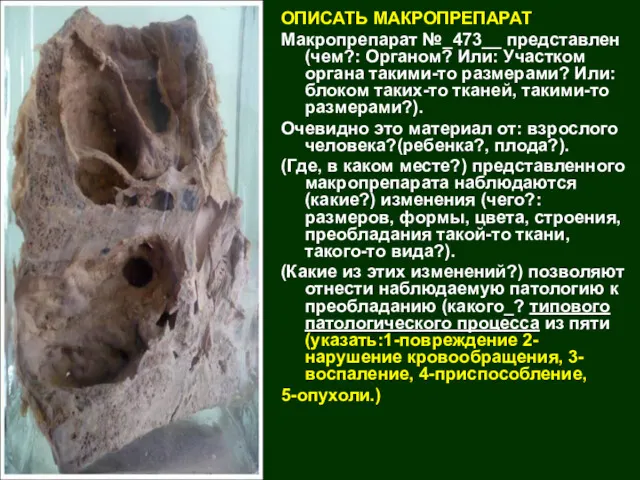 ОПИСАТЬ МАКРОПРЕПАРАТ Макропрепарат №_473__ представлен (чем?: Органом? Или: Участком органа