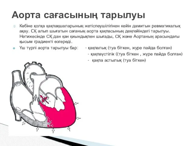 Көбіне қолқа қақпақшаларының жетіспеушілігінен кейін дамитын ревматикалық ақау. CҚ алып