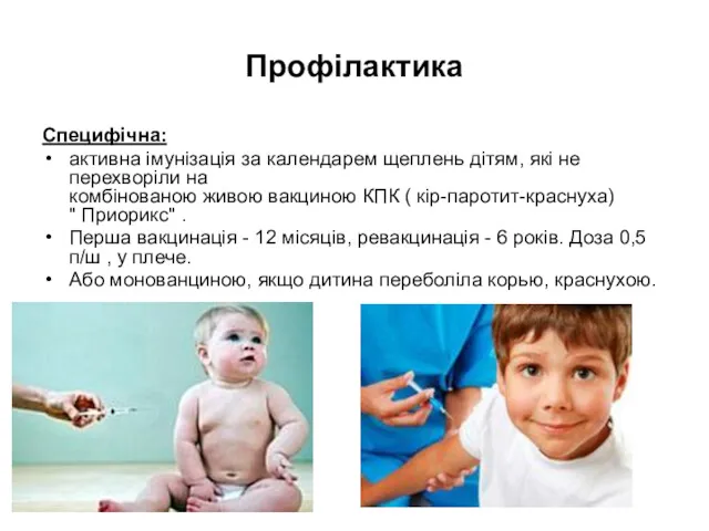 Профілактика Специфічна: активна імунізація за календарем щеплень дітям, які не перехворіли на комбінованою