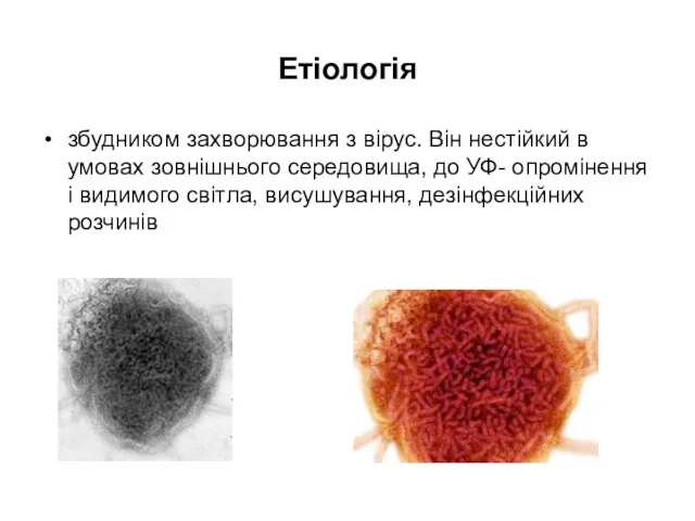 Етіологія збудником захворювання з вірус. Він нестійкий в умовах зовнішнього середовища, до УФ-