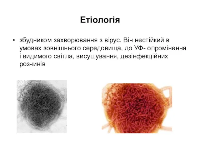 Етіологія збудником захворювання з вірус. Він нестійкий в умовах зовнішнього