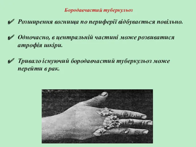 Бородавчастий туберкульоз Розширення вогнища по периферії відбувається повільно. Одночасно, в центральній частині може