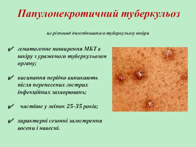 Папулонекротичний туберкульоз гематогенне поширення МБТ в шкіру з ураженого туберкульозом органу; висипання нерідко