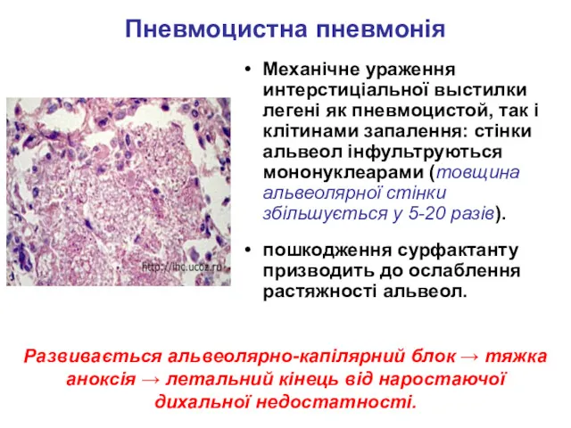 Пневмоцистна пневмонія Механічне ураження интерстиціальної выстилки легені як пневмоцистой, так