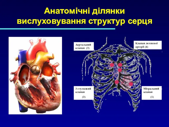 Анатомічні ділянки вислуховування структур серця Мітральний клапан (1) Клапан легеневої