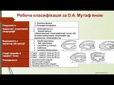 www.themegallery.com Робоча класифікація за О.А. Мутаф'яном: