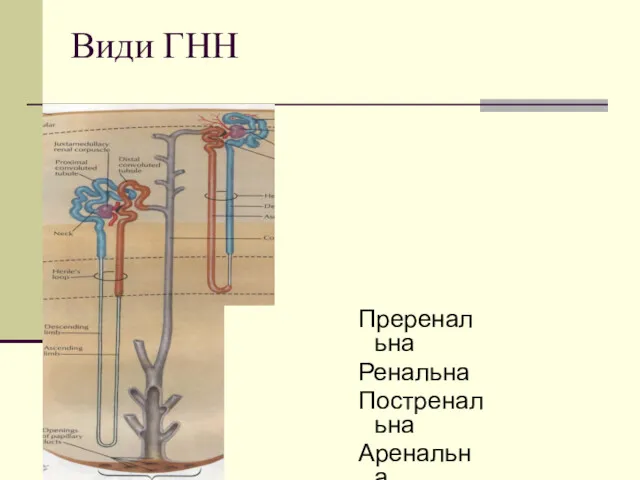 Види ГНН Преренальна Ренальна Постренальна Аренальна