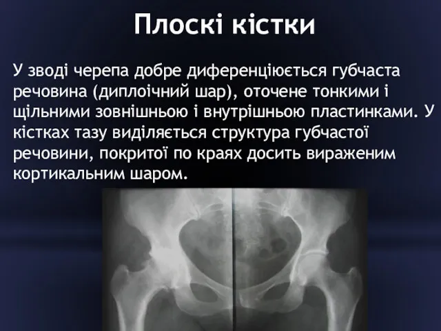 Плоскі кістки У зводі черепа добре диференціюється губчаста речовина (диплоічний шар), оточене тонкими