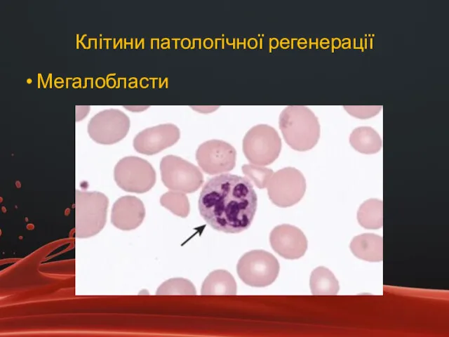 Клітини патологічної регенерації Мегалобласти