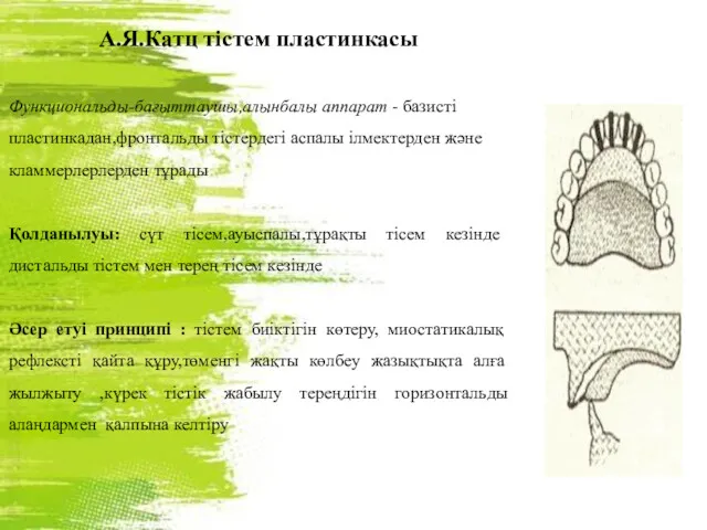 А.Я.Катц тістем пластинкасы Функциональды-бағыттаушы,алынбалы аппарат - базисті пластинкадан,фронтальды тістердегі аспалы