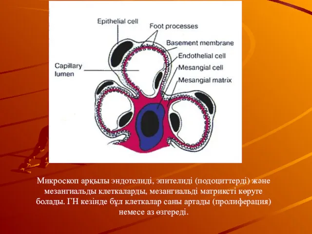 Микроскоп арқылы эндотелиді, эпителиді (подоциттерді) және мезангиальды клеткаларды, мезангиальді матриксті