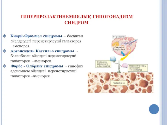 гиперпролактинемиялық гипогонадизм синдром Киари-Фроммел синдромы – босанған әйелдердегі персистирлеуші галакторея