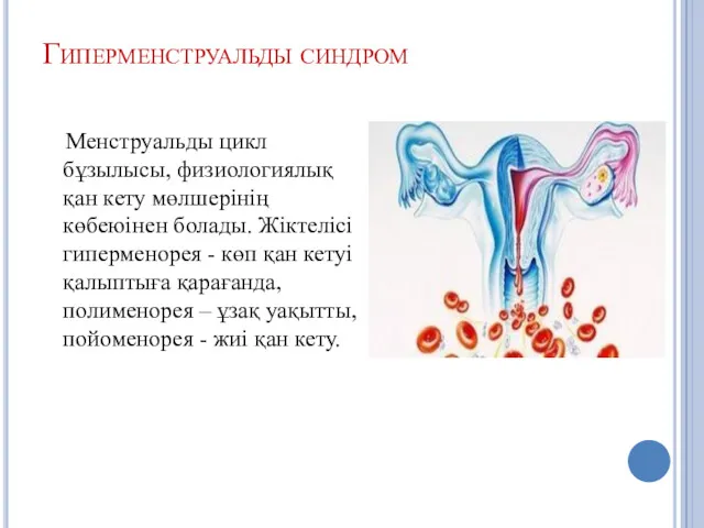 Гиперменструальды синдром Менструальды цикл бұзылысы, физиологиялық қан кету мөлшерінің көбеюінен