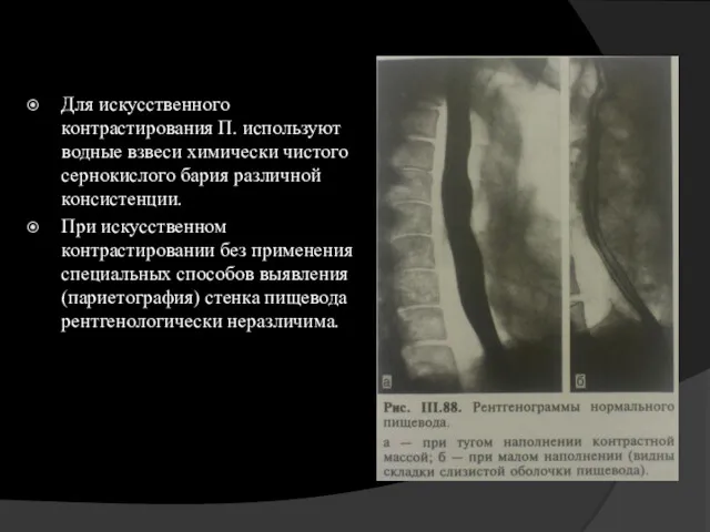 Для искусственного контрастирования П. используют водные взвеси химически чистого сернокислого