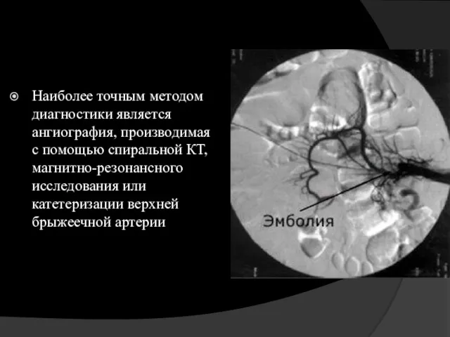 Наиболее точным методом диагностики является ангиография, производимая с помощью спиральной