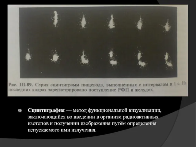 Сцинтиграфия — метод функциональной визуализации, заключающийся во введении в организм