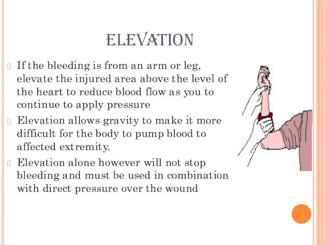 elevation If the bleeding is from an arm or leg,