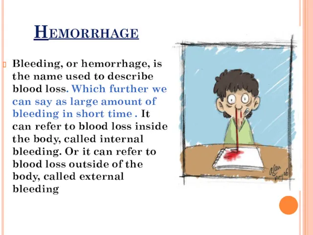 Hemorrhage Bleeding, or hemorrhage, is the name used to describe