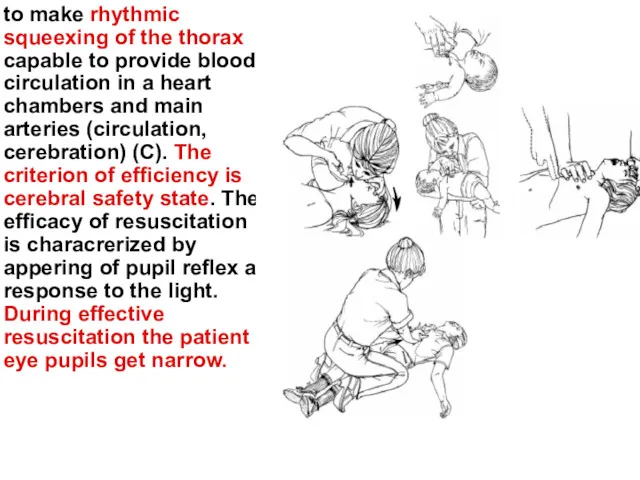 to make rhythmic squeexing of the thorax capable to provide