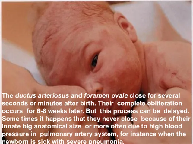 The ductus arteriosus and foramen ovale close for several seconds