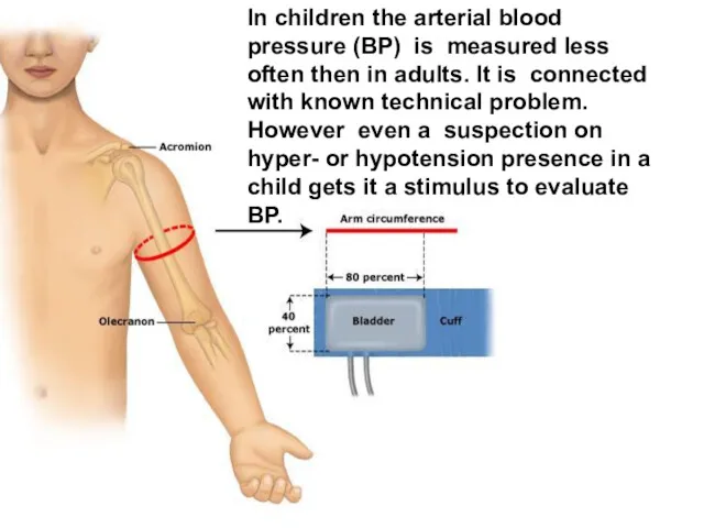 In children the arterial blood pressure (BP) is measured less