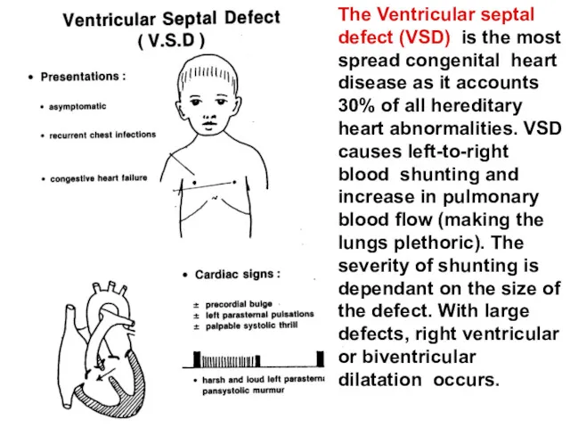 The Ventricular septal defect (VSD) is the most spread congenital