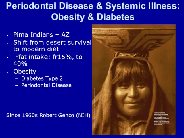 Periodontal Disease & Systemic Illness: Obesity & Diabetes Pima Indians