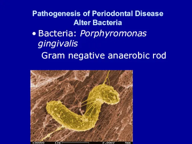 Pathogenesis of Periodontal Disease Alter Bacteria Bacteria: Porphyromonas gingivalis Gram negative anaerobic rod