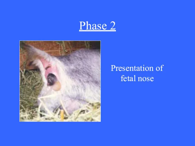 Phase 2 Presentation of fetal nose