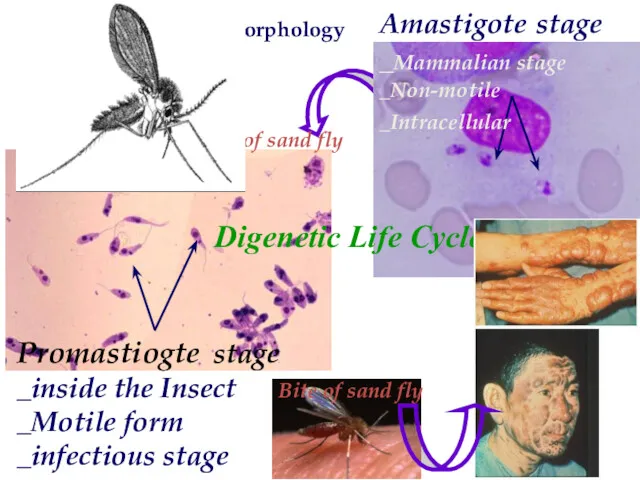 Bite of sand fly Bite of sand fly Leishmania Morphology