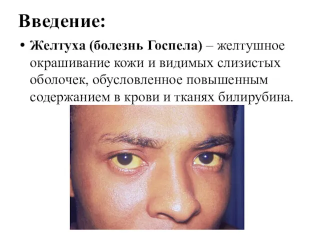 Желтуха (болезнь Госпела) – желтушное окрашивание кожи и видимых слизистых оболочек, обусловленное повышенным
