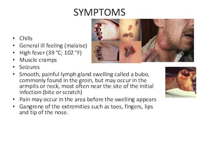SYMPTOMS Chills General ill feeling (malaise) High fever (39 °C;