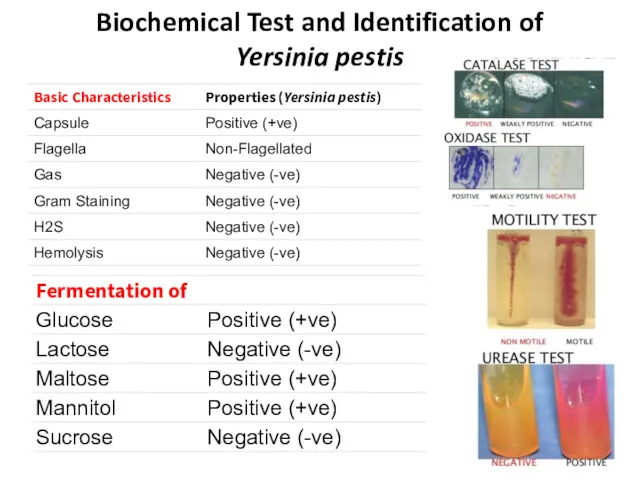Biochemical Test and Identification of Yersinia pestis