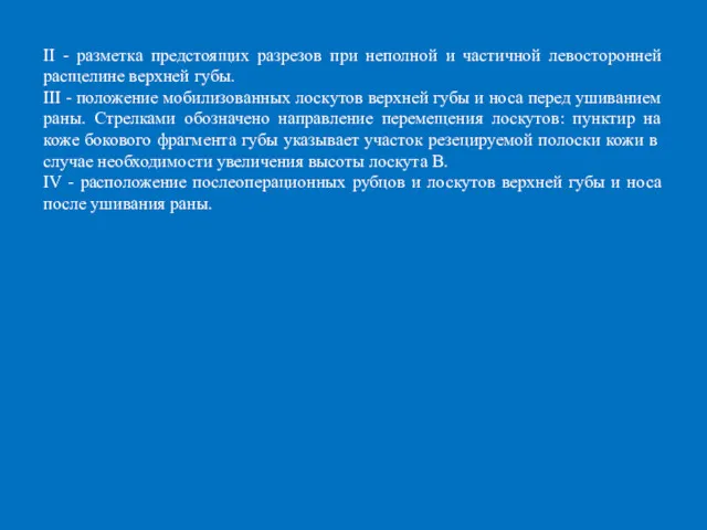 II - разметка предстоящих разрезов при неполной и частичной левосторонней