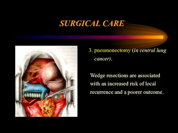 PRINCIPLES OF TREATMENT SURGICAL CARE 3. pneumonectomy (in central lung