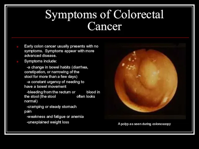 Symptoms of Colorectal Cancer Early colon cancer usually presents with no symptoms. Symptoms