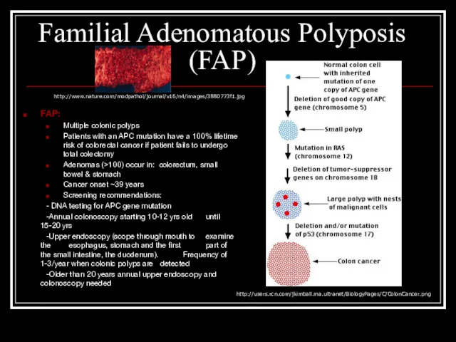 Familial Adenomatous Polyposis (FAP) FAP: Multiple colonic polyps Patients with an APC mutation