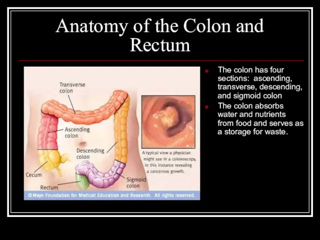 Anatomy of the Colon and Rectum The colon has four sections: ascending, transverse,