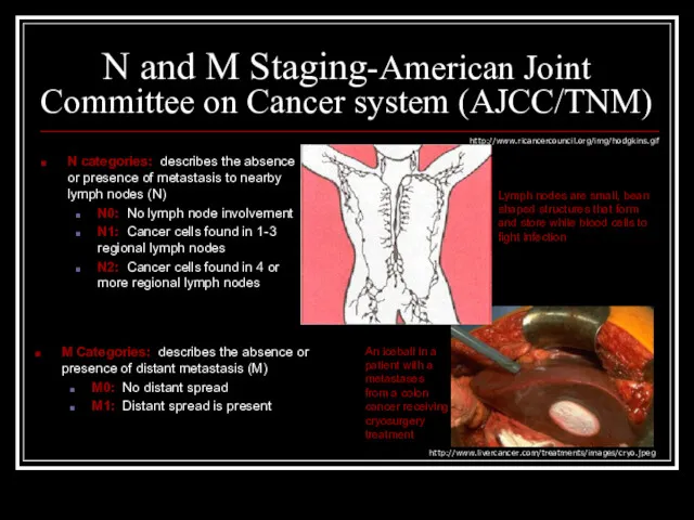 N and M Staging-American Joint Committee on Cancer system (AJCC/TNM) N categories: describes