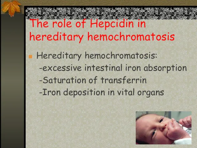 The role of Hepcidin in hereditary hemochromatosis Hereditary hemochromatosis: -excessive