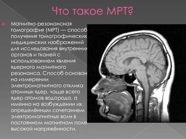 Что такое МРТ? Магнитно-резонансная томография (МРТ) — способ получения томографических