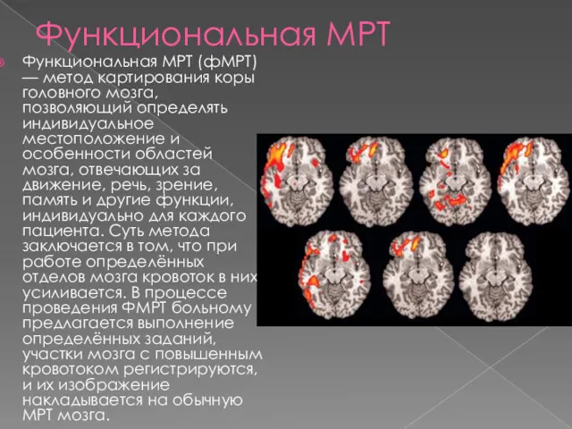 Функциональная МРТ Функциональная МРТ (фМРТ) — метод картирования коры головного