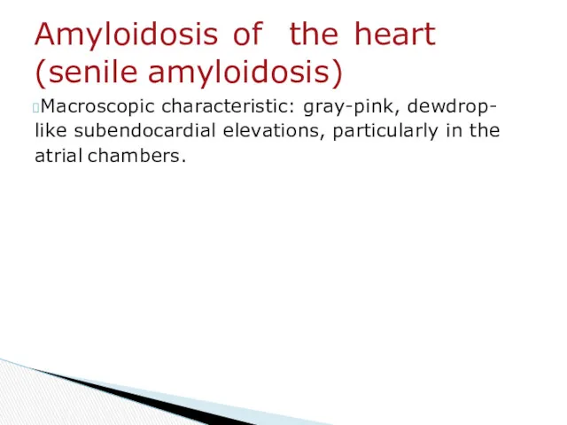 Macroscopic characteristic: gray-pink, dewdrop- like subendocardial elevations, particularly in the