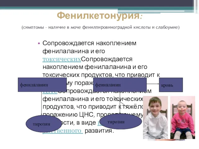 Фенилкетонурия: (симптомы – наличие в моче фенилпировиноградной кислоты и слабоумие)