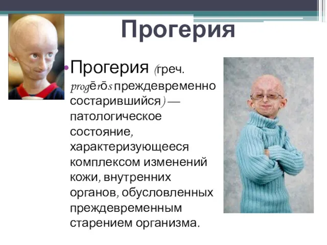 Прогерия Прогерия (греч. progērōs преждевременно состарившийся) — патологическое состояние, характеризующееся