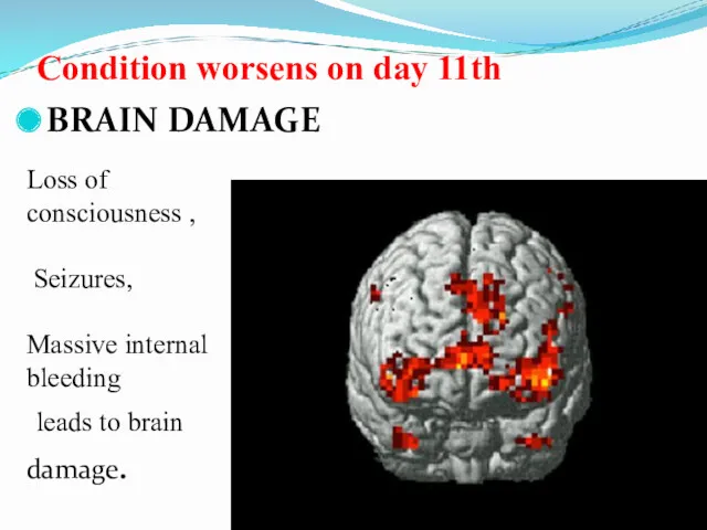 Condition worsens on day 11th BRAIN DAMAGE Loss of consciousness