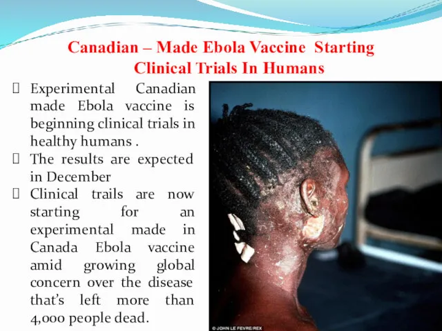 Experimental Canadian made Ebola vaccine is beginning clinical trials in