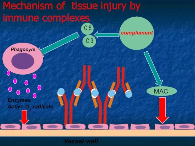 Mechanism of tissue injury by immune complexes Vessel wall Enzymes Active O2 radicals